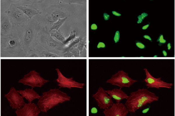 Brightfield, Green Fluorescence, Red Fluorescence, Merge 이미지 예시